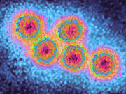 Indiana Reports Increase in Hepatitis A Cases Hepatitis A