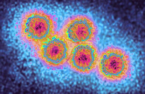 Indiana Reports Increase in Hepatitis A Cases Hepatitis A