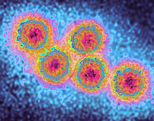 Indiana Reports Increase in Hepatitis A Cases Hepatitis A